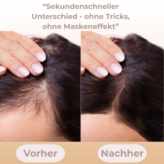 "Flawless Hairline – Makellos in Sekunden"