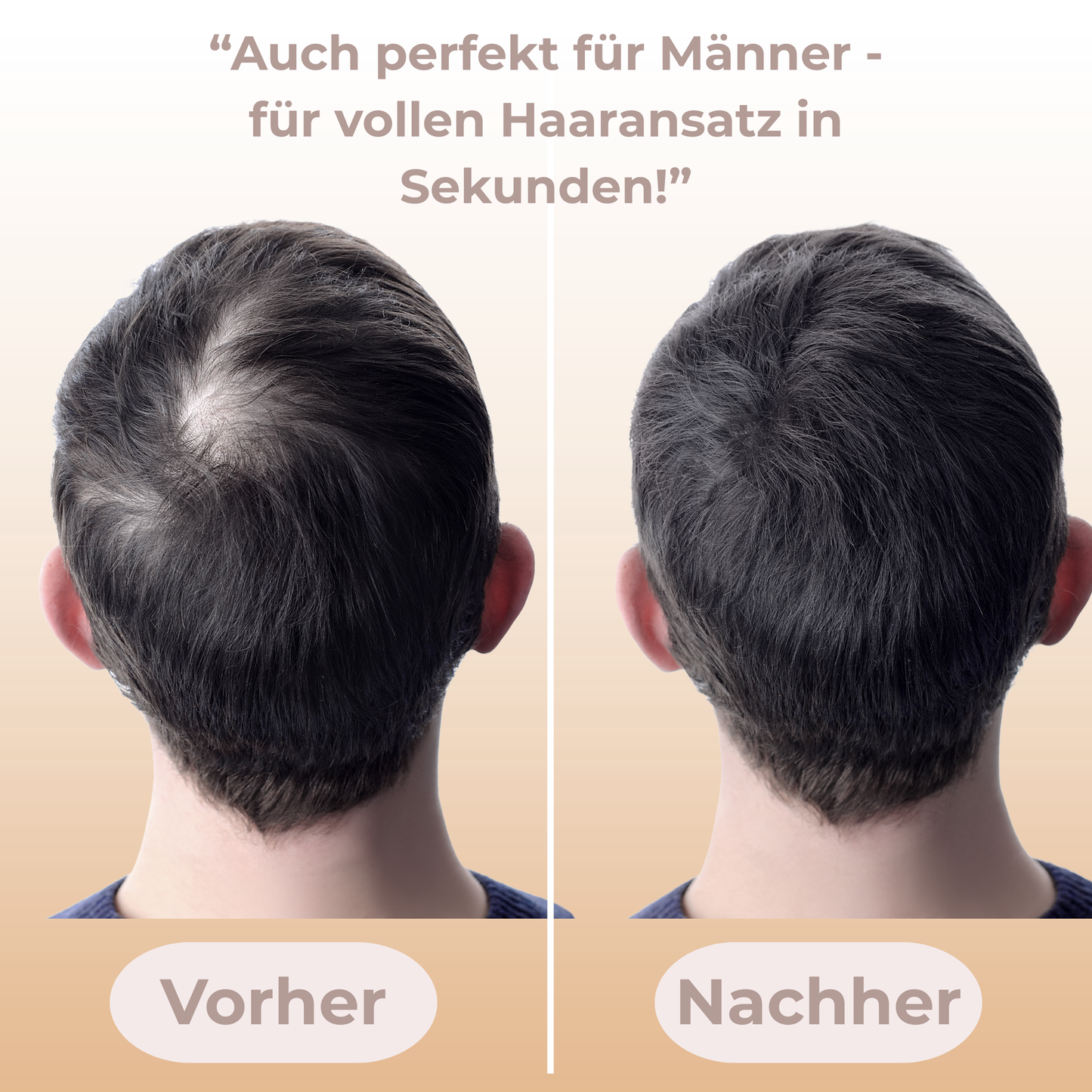 "Flawless Hairline – Makellos in Sekunden"